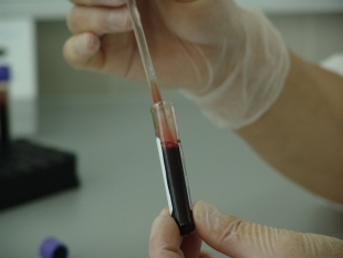Учёные: группа крови определяет личностные качества и физические особенности