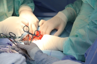Краснодарскому хирургу, пришившему лицо ребёнку, пришлось уволиться
