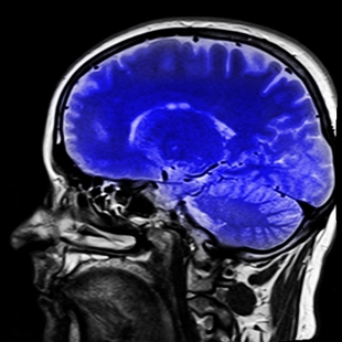 Учёный Парниа заявил о работе мозга после смерти